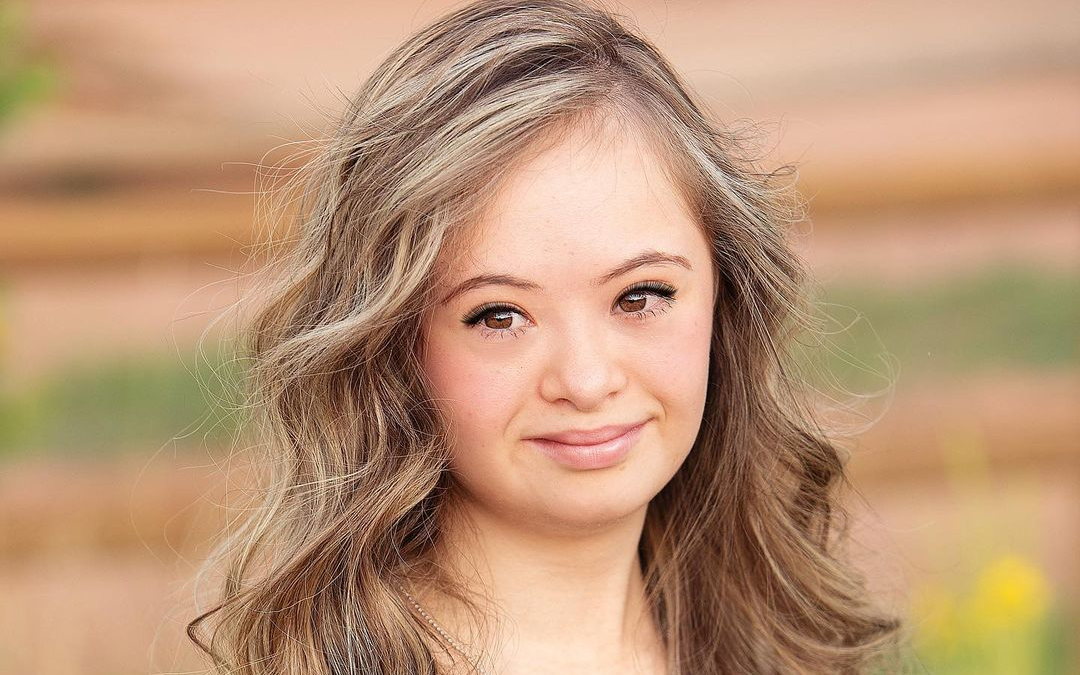 Boom, model with Down Syndrome